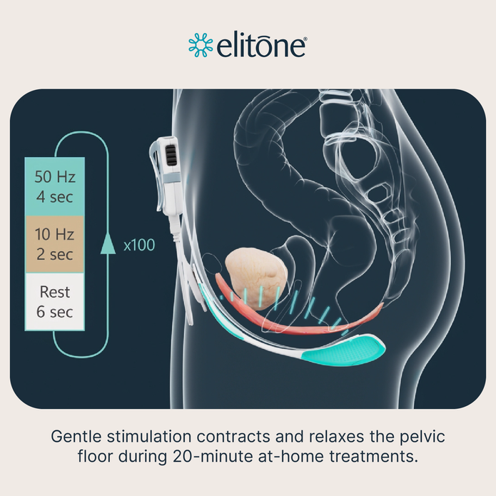 ELITONE Female Incontinence External Pelvic Floor Exerciser Therapy Kit
